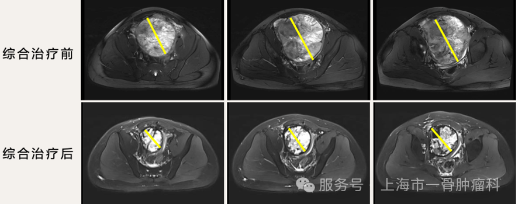 17821859317493.png 17821859317493.png